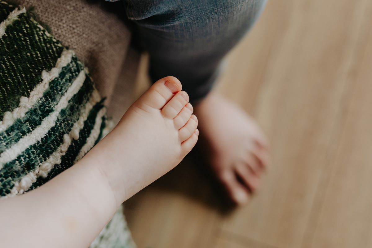 العظم الزائد للعُقيدة (Accessory Navicular)