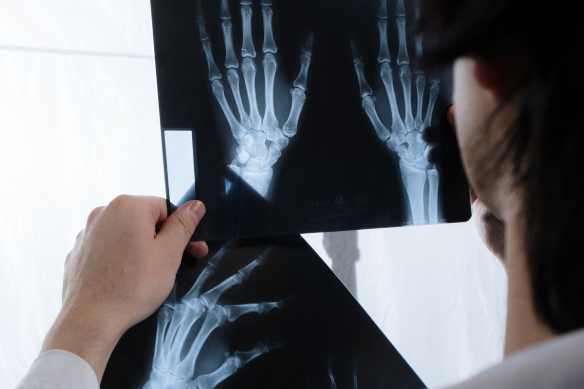 إصابات صفائح النمو عند الأطفال - د. معتصم الدهون