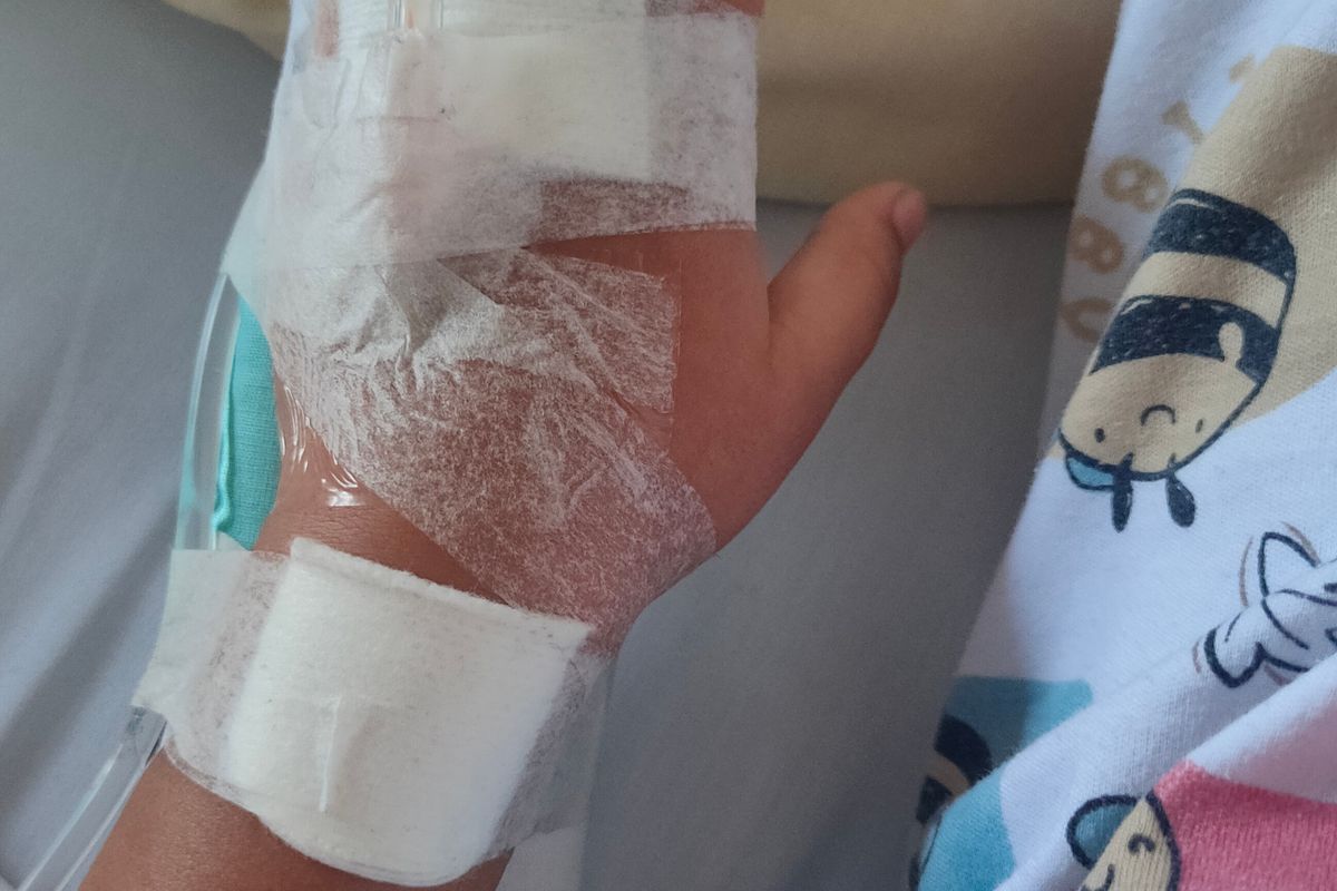 كسور الأطفال — دليل شامل للأهل - علاج Pediatric Fractures - د. معتصم الدهون استشاري جراحة عظام الأطفال عمان الأردن
