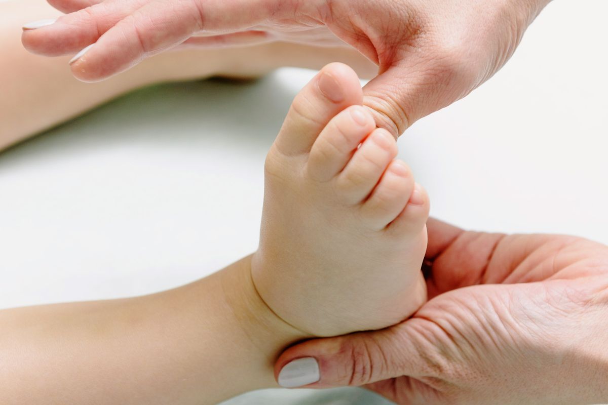 مرض بيرثيز (Perthes Disease)