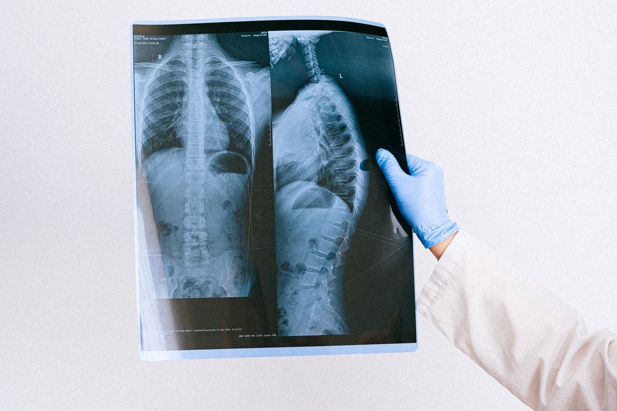 أشعة الأطفال — ما يجب أن يعرفه كل أب وأم - علاج Pediatric Imaging - د. معتصم الدهون استشاري جراحة عظام الأطفال عمان الأردن