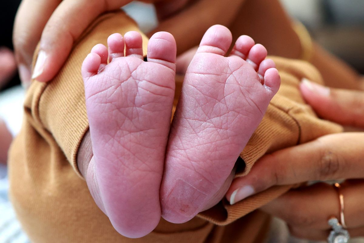 حنف القدم — طريقة بونسيتي بالتفصيل - علاج Clubfoot (CTEV) — Ponseti Method - د. معتصم الدهون استشاري جراحة عظام الأطفال عمان الأردن