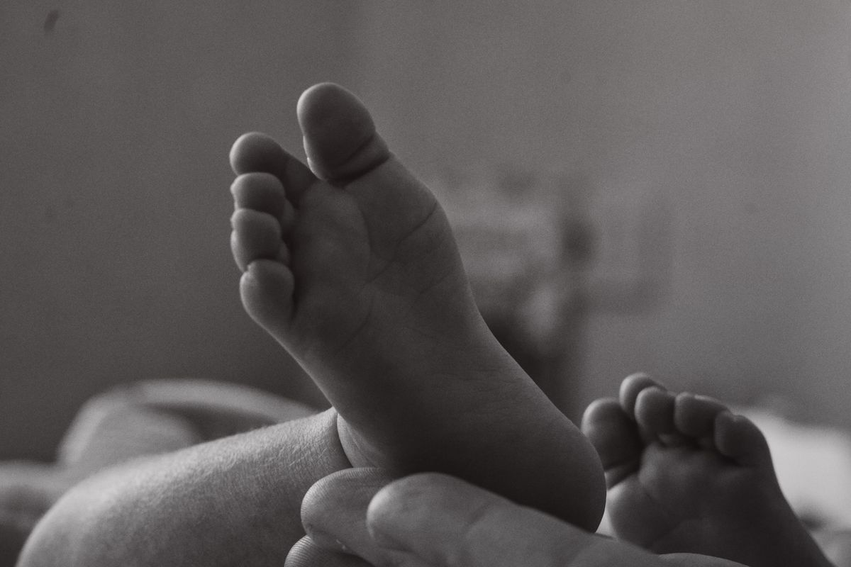 انحناء مقدمة القدم للداخل عند الرضع (Metatarsus Adductus) - د. معتصم الدهون